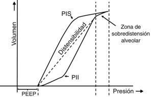 Lazo estático presión-volumen (P/V). Se representa el lazo estático P/V en pacientes con SDRA. Se puede observar la histéresis del sistema respiratorio, la que genera que el recorrido de la curva sea diferente en la inspiración y la espiración. Es decir, “la presión de la vía aérea necesaria para abrir los alvéolos es mayor que la necesaria para mantenerlos abiertos una vez que han sido reclutados”. Además, se pueden observar los puntos de inflexión superior (PIS) e inferior (PII), los cuales permitirían estimar la presión positiva al final de la espiración (PEEP) y el volumen corriente (Vc) óptimos.