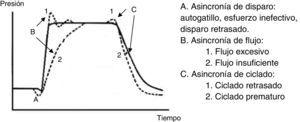 Curva presión-tiempo. Tipos de asincronía paciente-ventilador según el momento del ciclo donde se producen.