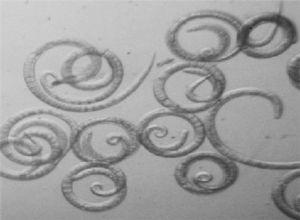 Larvas L1 de Trichinella spiralis. Larvas obtenidas por la técnica de digestión artificial y recuperadas mediante el embudo de Baermann modificado. Microscopio invertido (40X).