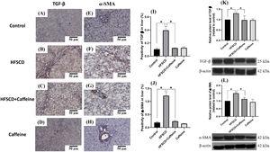 Caffeine maintains the basal levels of TGF-β and α-SMA in rats fed a high-fat, high-sucrose, high-cholesterol diet (HFSCD). Representative immunohistochemical images of TGF-β in the Control (A), HFSCD (B), HFSCD + Caffeine (C) and Caffeine groups (D) and α-SMA in the Control (E), HFSCD (F), HFSCD + Caffeine (G) and Caffeine groups (H) are shown. Scale bar = 50 μm. The positive area of TGF-β is shown in the histogram (I), and the positive area of α-SMA is shown in the histogram (J) (n = 4). The protein levels of TGF-β (K) and α-SMA (L) in liver tissue samples were determined by western blot analysis (n = 3), and β-actin was used as a control. The values are presented as fold increases in optical density values normalized to the values of the control group (control = 1). Each bar represents the mean value ± SE. (*) indicates P < 0.05.