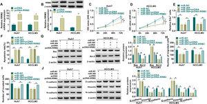 RRM2 overexpression impaired the effect of miR-384 overexpression on proliferation, migration, invasion, and apoptosis of HCC cells (A-B) qRT-PCR and Western blot analysis were used to detect the overexpression efficiency of RRM2. (C-J) Huh7 and HCCLM3 cells were transfected with miR-NC, miR-384, miR-384+pcDNA, or miR-384+pcDNA-RRM2. (C-E) CCK-8 and EdU assays were utilized to detect cell proliferation ability. (F) The Annexin-V FITC/PI staining was used to assess apoptotic rates. (G) Western blotting assay was employed to assess the protein levels of Bax and Bcl-2. (H-I) Transwell assays were used to determine cell migration and invasion ability. (J) Western blotting to assess the protein levels of E-cadherin, Vimentin and N-cadherin. *P < 0.05.