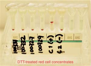 Panel de cribado de anticuerpos eritrocitos tratados con DTT, mostrando resultados negativos en 4 donantes de sangre. C1 (control positivo) C2 (control negativo).