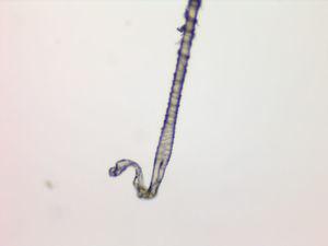 La inspección del pelo con el microscopio óptico revela incurvación de la raíz del pelo, acanalamiento de la parte distal y desflecamiento de la cutícula en la zona inmediatamente adyacente.