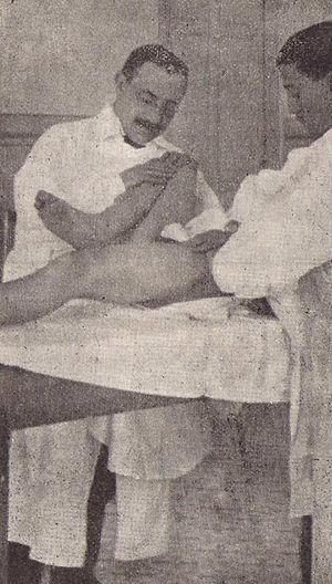 Aurelio Martín Arquellada realizando una reducción incruenta de una luxación de cadera. Libro de Actas del Primer Congreso Español de Pediatría, p. 341.
