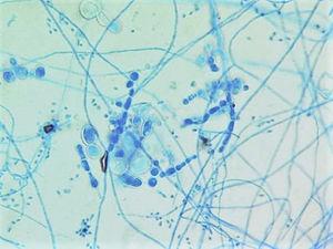 T. verrucosum crece a 37°C y presenta hifas con numerosas clamidosporas típicamente formando cadenas.
