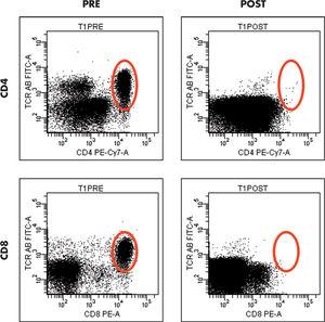 Análisis del resultado de un procedimiento de eliminación de linfocitos T en muestra de aféresis. A la izquierda se representa la muestra antes del procedimiento, y a la derecha después. En la parte superior se muestran los linfocitos T CD4 y en la inferior los T CD8. La cuantificación se realiza sobra la base de la cantidad de células contenidas en las áreas representadas en las elipses. Para identificar los linfocitos T se combinaron anticuerpos anti-CD4, anti-CD8 y anti-TCRαβ.