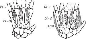 The left panel depicts the palmar interosseus muscles. These are three and given their disposition they bring the index, the anular and the little finger toward the 3rd finger which is the axis of the hand. The dorsal interosseus muscles are shown in the right panel. The middle finger has two and the anular and the index fingers have one. Their disposition is such that they separate the fingers from the 3rd finger, and move the 3rd finger to one and the other side. From A Companion to Medical Studies, Volume 1, Ed. by Passmore R and Robson JS, 2nd Edition, Oxford, Wiley/Blackwell 1976, p. 23.20, with permission.