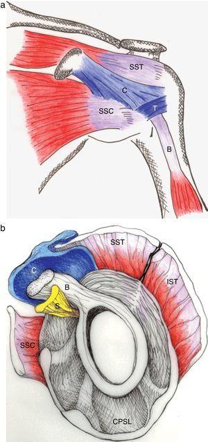 (a) The coracohumeral ligament (C) inserts in the coracoid and extends laterally to the humerus covering the long head of the biceps tendon. Its insertion is in the lesser and greater tubercles of the humerus and in the fascia of the subscapularis (SSC) and supraspinatus (SST) muscles. T is the transverse humeral ligament that keeps the biceps tendon in the intertubercular groove. (b) As seen in this sagittal section, the coracohumeral ligament fills the space between the upper edge of subcoracoid (SSC) and the anterior edge of supraspinatus (SST). This gap, which includes the tendon of the long head of biceps (B) and the superior glenohumeral ligament (S) is widely known as the “rotator interval”.