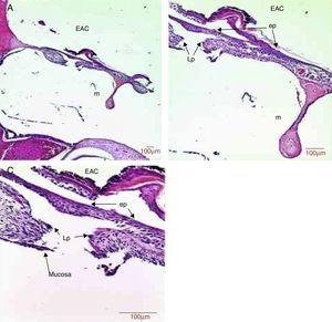 Histological section images of rat TM 5 days after traumatic perforation, stained with HE. EAC, external auditory canal; m, malleus handle; ep, epithelial layer; Lp, lamina propria; mucosa, mucosal layer. Image (A) shows a magnification of 40×; (B) 100× and (C) 400×.