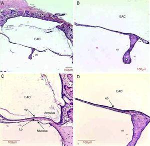 Histological section images of rat TM 10 days after traumatic perforation, stained with HE. EAC, external auditory canal; m, malleus handle; ep, epithelial layer; Lp, lamina propria; annulus, tympanic annulus; mucosa, mucosal layer. Image (A) shows a magnification of 40×; (B) 100× and (C and D) 200×.