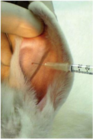 Ear infiltration with 2% lidocaine and norepinephrine vasoconstrictor, at a concentration of 1:200,000 (Xylocaine®).