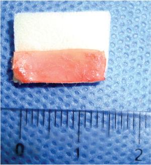 Preparing a 1.5-cm long strip of cartilage, measured with a surgical compass without Gelfoam®.