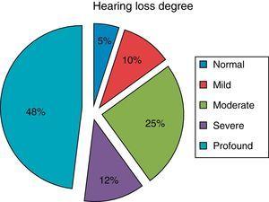 auditory neuropathy spectrum disorder