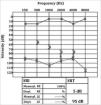 Mastoiditis and facial paralysis as initial manifestations of Wegener's ...