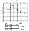 Mastoiditis and facial paralysis as initial manifestations of Wegener's ...