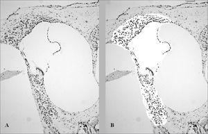 The Role Of Apoptosis In Cisplatin-induced Ototoxicity In Rats ...