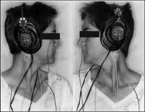 Position of the patient in lateral rotation and position of reference and ground surface electrodes