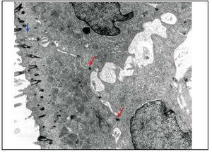 Slide with frog palate epithelium from group 5 showing increase in intercellular space and presence of intercellular junctions: desmosomes (red arrow) and tight junction (blue arrow). The increase in transit of fluid to extracellular matter is morphological evidence of increase in permeability of epithelial barrier (transmission electron microscopy, 10,000 times magnified).