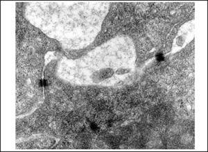 Slide with frog palate epithelium from group 5 showing detail of the slide above, showing two desmosomes and increase in intercellular space with fluid material containing proteins (flocculation) (transmission electron microscopy, 40,000 times magnified).
