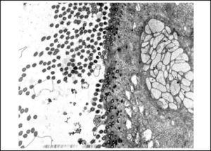 Slide with frog palate epithelium from group 1 showing cilia at transversal section and mucous contained in mucous cell (transmission electron microscopy, 800 times magnified).