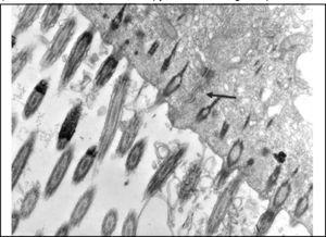 Slide with frog palate epithelium from group 1 showing cilia at longitudinal section and preserved tight junction (arrow) between two contiguous cells (transmission electron microscopy, 20,000 times magnified)