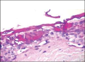 Slide with frog palate epithelium from group 5 showing disorganization of epithelium and increase in volume of extruded mucus (light microscopy, PAS-AB staining, 100 times magnified)