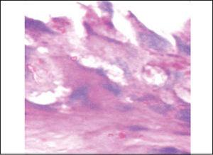 Slide with frog palate epithelium from group 4 showing epithelial disorganization, cell edema and complete extrusion of mucus (light microscopy, PAS-AB staining, 400 times magnified).