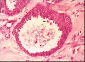 Arrow: secretion by apical decapitation (HE, objective 40X).