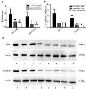 Detection of gene expression and protein expression levels of histamine H1 and leukotriene CysLT1 receptors of AR participants before and after medication. (A) Quantification of mRNA levels of histamine H1 and leukotriene CysLT1 receptors analyzed by qPCR. (B) Quantification of protein levels of histamine H1 and leukotriene CysLT1 receptors analyzed by Western blot. (C) Western blot images of histamine H1, leukotriene CysLT1 and control proteins. Prior treatment: Lane 1, 2, 3; post treatment: Lanes 4, 5, 6, and healthy control: Lanes 7, 8. β-Actin and γ-tublin were respectively used as control for histamine H1 and leukotriene CysLT1 receptors in qPCR and Western blot.