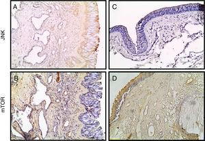 Photomicrographs of JNK, and mTOR staining within the turbinate tissue (A, B) and NPs (C, D) tissues is depicted. (Original magnification ×200).