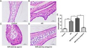 MiR-223-3p promoted an allergic inflammatory response in the nasal mucosa of AR mice. (A–D) The pathological changes in nasal mucosa from each group were analyzed using H&E staining. (E) The number of eosinophils in each group was quantified. (*p < 0.05, **p < 0.01, ***p < 0.001.