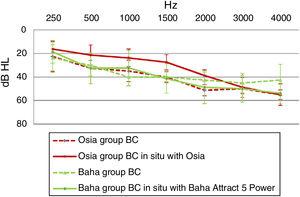 The difference in bone conduction between the measurements in situ with an implanted device, and those performed preoperatively by using pure tone audiometry with headphones − for the Osia group and the Baha group.