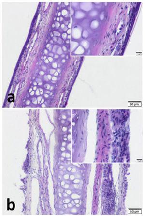 Septal cartilage with covering mucoperichondrium. Increased cellularity and sub-epithelial oedema is notable in pregnant group. (a) Control group (b) Pregnant group (H&E stain) (Scale Bars=50μm and 10μm).
