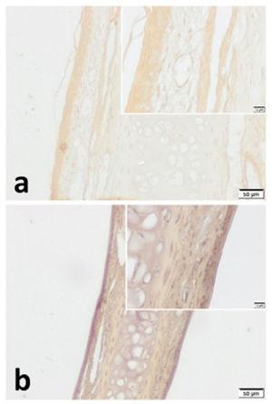 VPAC1 immunohistochemistry for (a) Control group and (b) Pregnant group. VPAC1 was found to be expressed in all layers of septal mucoperichondrium. Additionally, it was more intense in the surface epithelium of both groups. Overall staining intensity was more explicit in specimens of pregnant group. (Scale Bars =50μm and 10μm).
