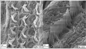 SEM micrograph in the group N-T: IHCs and OHCs had rupture in the rows of (a) OHCs stereocilia, (b) IHCs sterocilia.