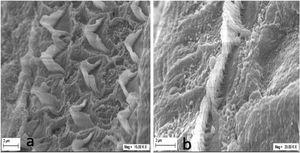 SEM micrograph in the group T-N: (a) Partial loss of OHCs stereocilia; (b) Mild degeneration was observed in IHCs stereocilia.