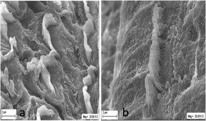 SEM micrograph in the group T-T: (a) Partial loss in OHCs stereocilia; (b) Mild degeneration and rupture in IHCs stereocilia.