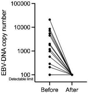 Plasma EBV-DNA level before and after ACRT. (a) Plasma EBV-DNA before ACRT, (b) Plasma EBV-DNA three months after ACRT. Measurable EBV-DNA were detected in 13 of 27 cases. All 13 cases showed a decrease in EBV-DNA three months after ACRT.