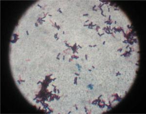 – Otografía del cultivo de líquido cefalorraquídeo de Listeria.