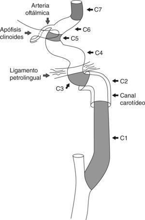 Diagrama anatómico de la arteria carótida interna.