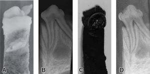 A y B) Fotografía y radiografía de un espécimen antes de ser sometido a altas temperaturas; C y D) fotografía y radiografía de un espécimen después de ser sometido a 600 oC.