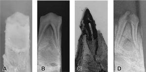 A y B) Fotografía y radiografía de un espécimen antes de ser sometido a altas temperaturas; C y D) fotografía y radiografía de un espécimen después de ser sometido a 800 oC.