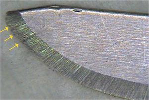 Elite® D3 scalpel blade after use. Edge opacity is noticeable in the sharp edge; this can be interpreted as physical deformation of the blade.