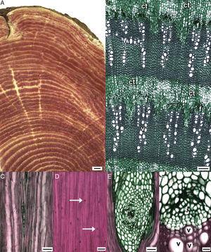 Wood of Iresine latifolia with successive cambium. Transverse (A, B, F) and tangential (C–E) sections. A, Stem showing successive cambia with abundant vascular rings; B, detail of vascular rings, showing the vessels in radial multiples, phloem, and conjunctive unlignified tissue; C, uniseriate ray and vessel elements with simple perforation plates and intervascular alternate bordered pits; D, nucleated libriform fibers; E, multiseriate unlignified ray with meristematic center; F, cambial zone with 2–3 layered cambial cells. Bars are 1mm in (A), 100μm in (B), 50μm in (C, E), and 20μm in (D, F). ct: conjunctive tissue; f: fiber, v: vessel; arrows: nuclei.