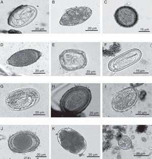 Eggs of intestinal parasites identified in jaguar and puma fecal samples collected in southeastern Mexico: A=Physaloptera sp.; B=Spirometra sp.; C=Taeniidae; D=Trichuris sp.; E=Anoplocephalid; F=Spirocerca sp.; G=Strongyloides sp.; H=Acanthocephalan; I=Ascarid-like egg; J=Toxocara sp.; K=Ancylostoma sp.; L=coccidian.