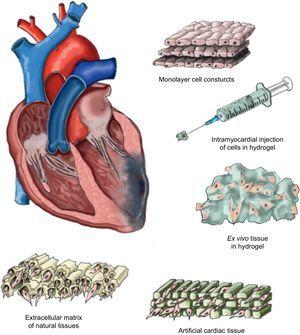 Cardiac tissue engineering. Drawing outlining the different approaches taken in the field of cardiac tissue engineering.