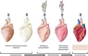 Neo-organogenesis: bioartificial heart. Schematic representation of the different stages in the decellularization and recellularization of a heart. Initially, physical, chemical and enzymatic decellularization is intended to preserve the extracellular cardiac matrix and vascular tree. Next, autologous vascularization is induced followed by heterologous parenchymal recellularization in order to finally generate a new functional heart.