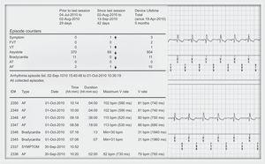 Electrocardiographic record (in PDF format) of a recorded episode due to symptoms. AF, atrial fibrillation; AT, atrial tachycardia; FVT, fast ventricular tachycardia; V, ventricular; VT, ventricular.