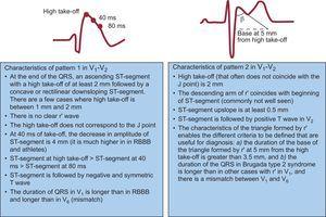 Electrocardiographic patterns of Brugada syndrome in V1-V2. RBBB: right bundle branch block bundle. Adapted from Bayes de Luna et al30 with permission.
