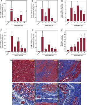 Analysis of cardiac fibrosis after AMI. mRNA expression of collagen I (A), collagen III (B), TGFβ (C), Gal-3 (D), and α-SMA (E). Data normalized with respect to GAPDH and compared with control. Using Masson trichrome staining, the collagen volume was determined in the infarcted myocardium (F). Representative photomicrographs (40×) and quantitative analysis of interstitial fibrosis expressed as collagen volume fraction (G). α-SMA, alpha-smooth muscle actin; AMI, acute myocardial infarction; Col I, collagen I; Col III, collagen III; Gal-3, galectin-3; GAPDH, glyceraldehyde 3-phosphate dehydrogenase; mRNA, messenger ribonucleic acid; TGFβ, transforming growth factor beta. aP < .001 vs the control group. bP < .01 vs the control group. cP < .05 vs the control group.